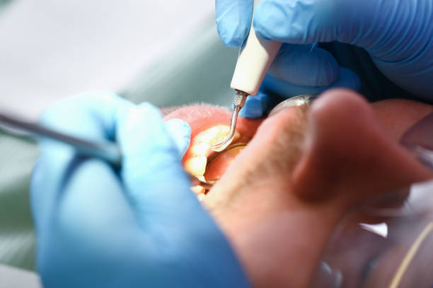  University, MS Emergency Dentist Pros