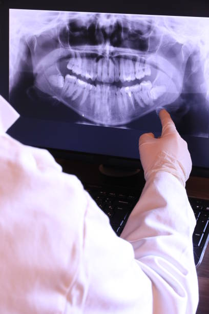 Best Emergency Wisdom Teeth Removal in University, MS