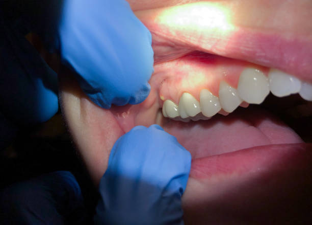 Best Pediatric Emergency Dentist in University, MS