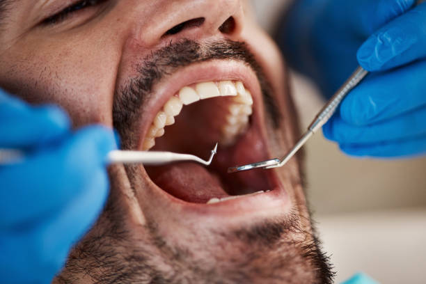 Best Weekend Emergency Dentist in University, MS